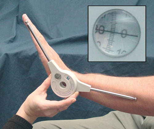 Extendable Goniometer for Accurate Joint Measurement