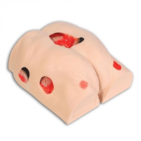 Seymour II Decubitus Wound Care Model for Training and Practice