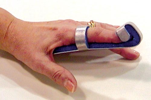 Baseball Finger Splint Large Bulk PK/6 Non-Retail Supply